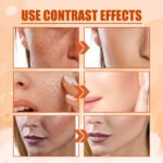 EELHOE Vitamin C Moisturizing Spray Moisturizing And Moisturizing Skin Lightening Acne Spots Rejuvenating And Whitening Spray